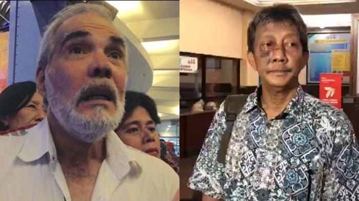 Artis Senior Pierre Bruno Aniaya Korban Hanya Karena Merasa Dipandang Sinis, Kini Jadi Tersangka!