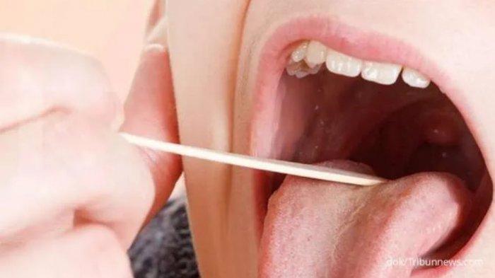 Ayah Beberkan Anaknya Meninggal Setelah Operasi Amandel, Ini yang Dialami Setelah Operasi