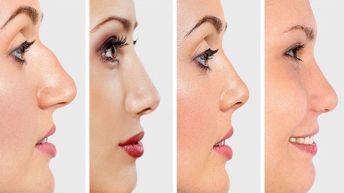 Bentuk hidung seseorang