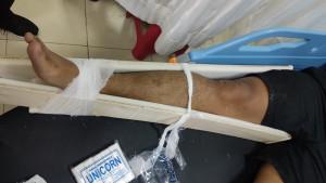 IGW-31-korban-pengeroyokan-geng-anak-muda-896.jpg