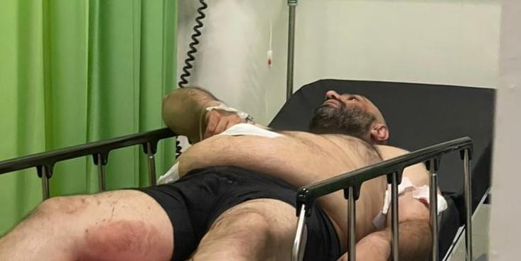 WNA asal Turki Diberondong Tembakan di Bali, Kejadiannya Mirip Adegan Film Spionase