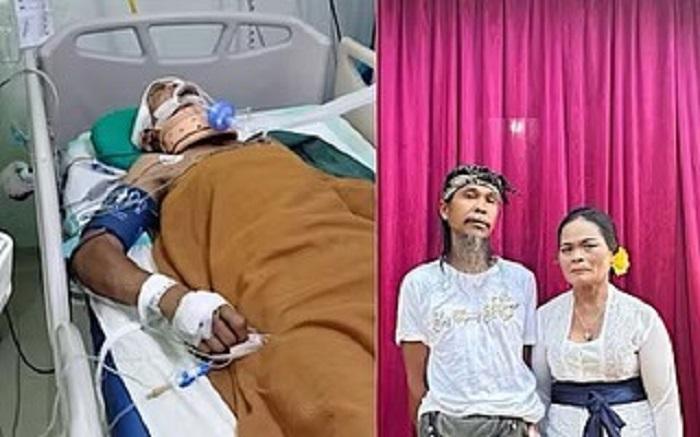 DIRAWAT-INSTENSIF-Niat-mencari-rezeki-berujung-petaka-bagi-Dewa-Ngakan-Ketut-Kicen.jpg