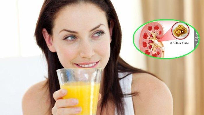 Jaga Kesehatan Ginjal Anda dengan Konsumsi Deretan Makanan Sehat Berikut Ini, Apa Saja?