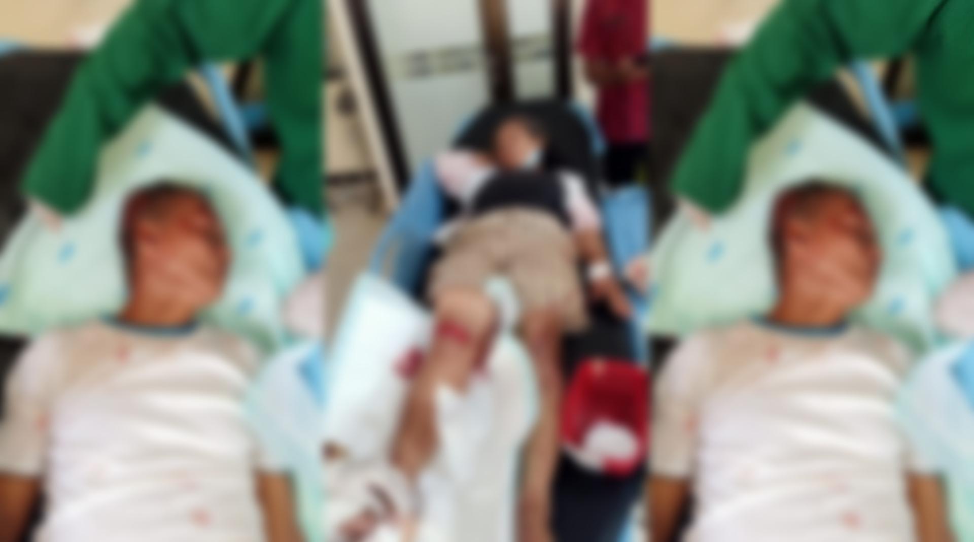 TANGIS Ketut Idri Pecah di Jalan Singaraja Kintamani, Suami Terkapar Setelah Kecelakaan