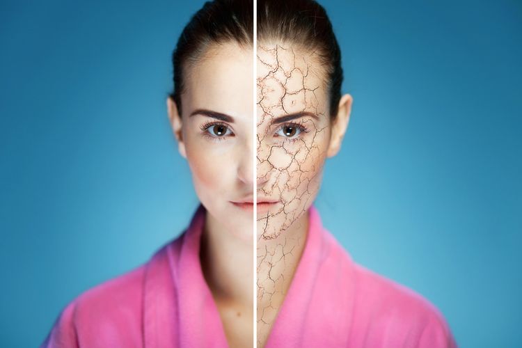 Waspada, Kulit Kering Bisa Mengindikasikan Ada Penyakit di Dalam Tubuh