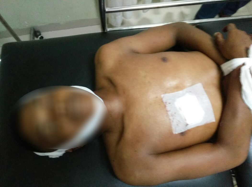 Terkuak, Hanya Gara-gara Ini Picu Penusukan Prada Yanuar, Anak Anggota DPRD Ini Jadi Tersangka Utama