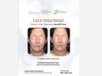 Ultimate-miracle-face-treatment-before-after.jpg