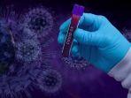 ilustrasi-covid-19-10-kasus-positif-corona-di-jembrana.jpg