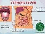 infografis-tipes-ciri-ciri-tipes-pada-tubuh.jpg
