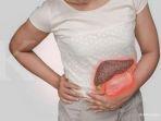 Sayangi Hatimu! Berikut 5 Penyebab Penyakit Liver yang Perlu Diwaspadai
