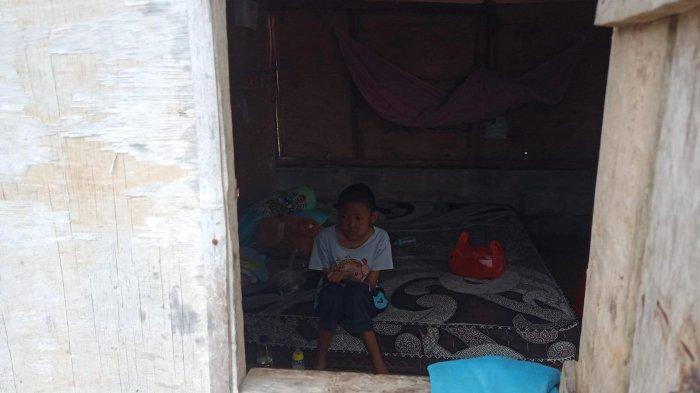 Dinsos Bangka Tengah Akan Cek Bantuan Sosial untuk Amel Penderita Lupus dan Keluarganya