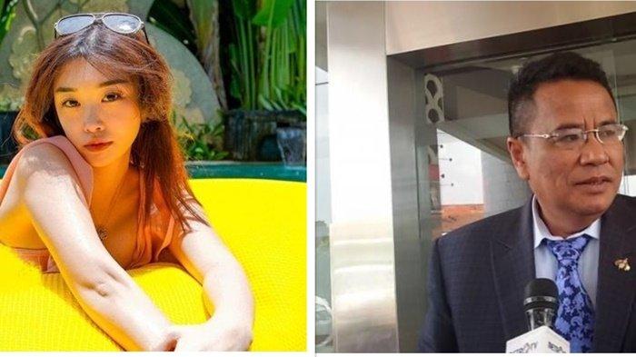 Isi DM Hotman Paris ke Livy Renata Terungkap, Begini Reaksi Sang BA Alter Ego