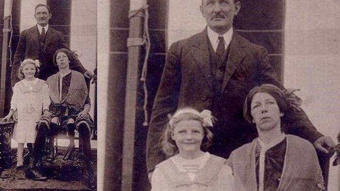 Kisah Nyata Wanita Memiliki 4 Kaki, Akhirnya Hidupnya Tragis, Kuburannya Dicor Beton