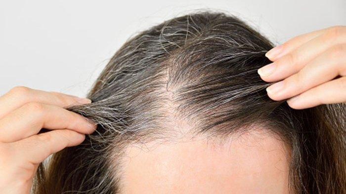 Manfaat Belimbing Wuluh Untuk Menghilangkan Uban, Rambut Tetap Hitam, Begini Cara Mengolahnya