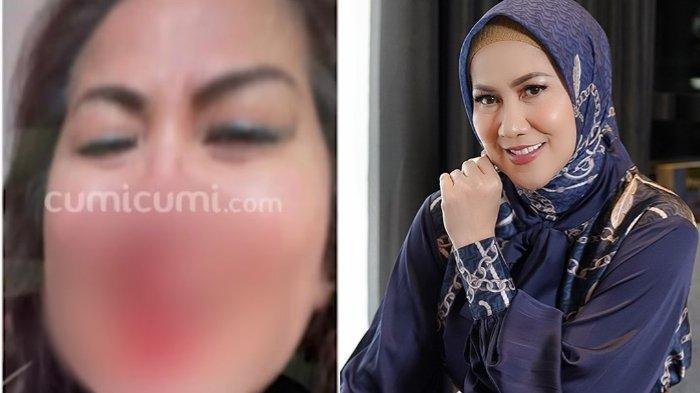 Sudah Mengaku KDRT, Ferry Irawan Belum Ditahan, Venna Melinda Sampai Curhat ke Hotman Paris