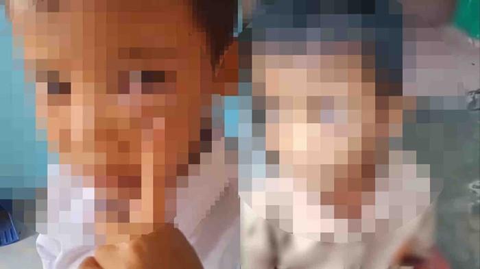 Tangkapan layar kondisi anak dengan mata lebam diduga dipukul oleh ayah kandungnya sendiri