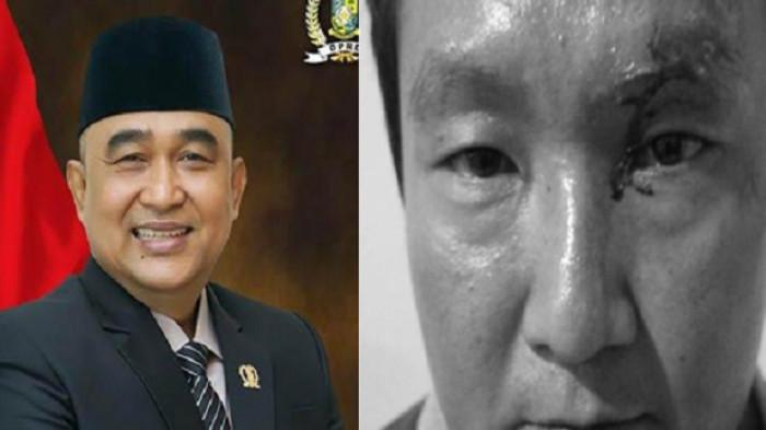 Sosok Tony Hidayat, Anggota DPRD Kampar Disiram Air Cabai, Modus Pura-pura Tumpahkan Kuah Soto