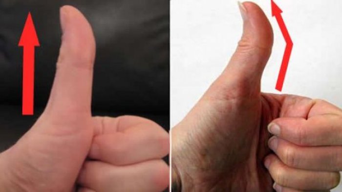 Cuma Lihat Jempol di Postingan Cewek Lain, Wanita Ini Mampu Pergoki Pacar Selingkuh