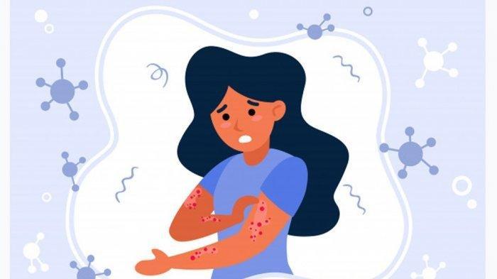 Campak Terkadang Menyebabkan Komplikasi Serius, Waspadai 8 Gejalanya