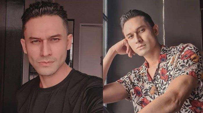 Sempat Terlihat Kurus, Indra Bruggman Ternyata Idap Hipertiroid, Tiap Ngobrol Gemetaran