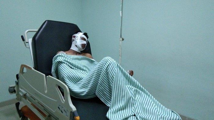 Ahmad Suntar (21) korban mobil yang terbakar didepan SPBU saat berada di RSUD Marsidi Judono, Jumat (24/1/2020) sore.