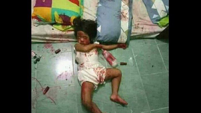 Brigjen Pol Krishna Murti Posting Bocah Tergeletak di Kamar, Fakta Sebenarnya Bikin Ngelus Dada