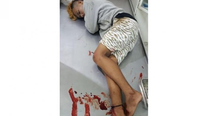 Nafsu Mendadak Naik, Pria Ini Perkosa Nenek-nenek Setelah Ditikam Hingga Tewas