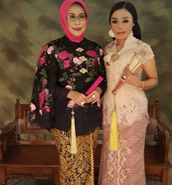 14 Tahun Berlalu Ini Kabar Lisa Face Off yang Disiram Air Keras, Jadi Pengusaha Perhiasan Sukses!