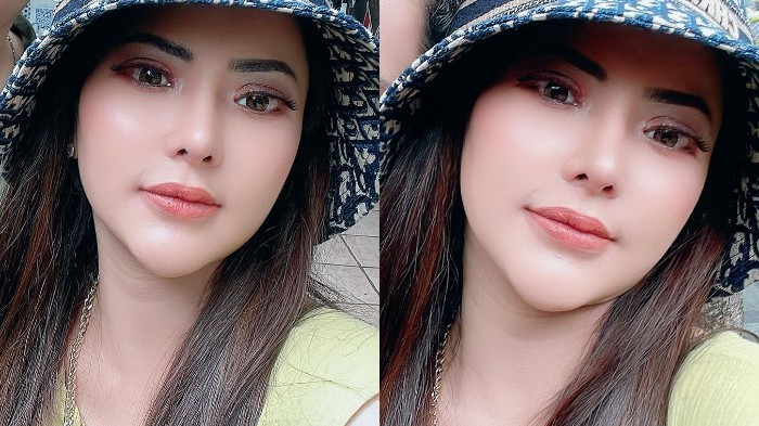 Ayu Aulia Akui Punya Hubungan dengan Ridwan Kamil hingga Atalia Tak Mau Dimadu