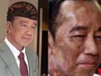 20251008-Jokowi-Sakit-Apa-Wajah-Makin-Putih-dan-Tidak-Boleh-Terpapar-Matahari.jpg