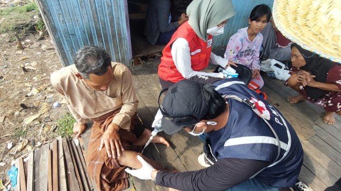 Gagal Padamkan Api Karhutla yang Sambar Rumahnya, Kaki Buruh Pengupas Galam di Banjarbaru Melepuh