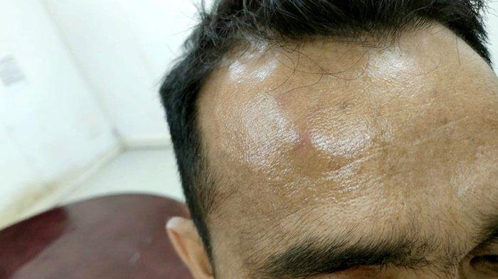 Hajar 2 Orang di Tempat Kerja, Pelaku Kabur dalam Pencarian Polsek Kelumpang Utara Kotabaru