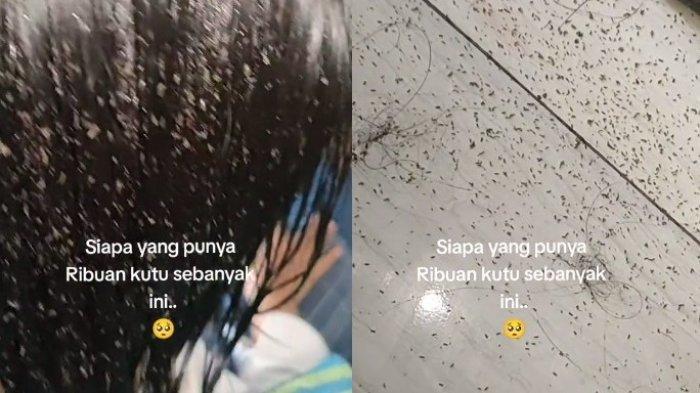 Viral Penampakan Ribuan Kutu Bersarang di Rambut Bocah asal Trenggalek Jawa Timur, Bikin Merinding