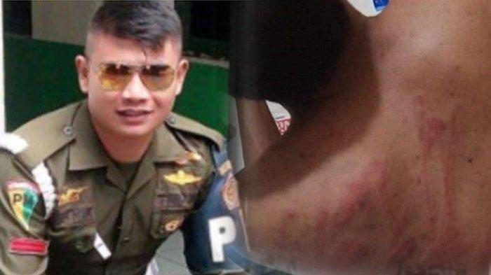 Hotman Paris Bongkar Trauma di Kepala Para Korban Penculikan Oknum Paspampres Praka RM,  Sejak Lama