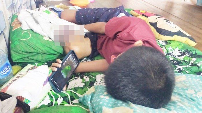 Tumor Tulang Makin Membesar Membuat Anak 12 Tahun di Balangan Kalsel Ini Tak Bisa Lagi Sekolah