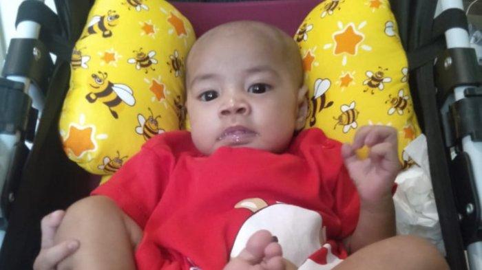 Kondisi Bayi Jantung Bocor Asal Batola Terus Membaik, Begini Perkembangannya