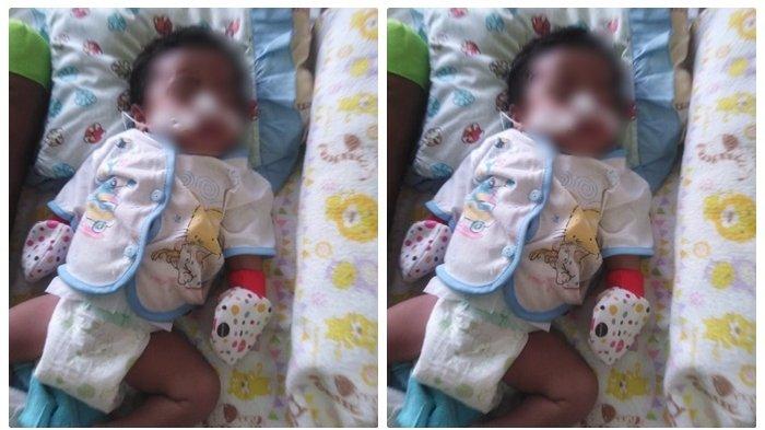 Bingung Biaya Pendampingan Sang Anak yang Alami Jantung Bocor, Fazjrianoor Harapkan Bantuan Relawan