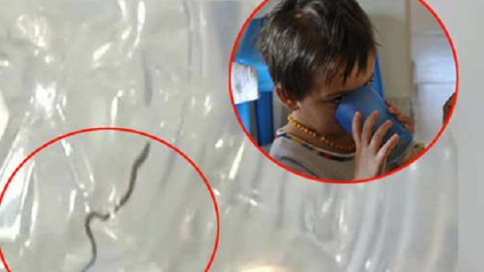 Ngeri, Ada Ular di Air Minum Dispenser Rumah Sakit, Hampir Saja Tertelan Anak Ini
