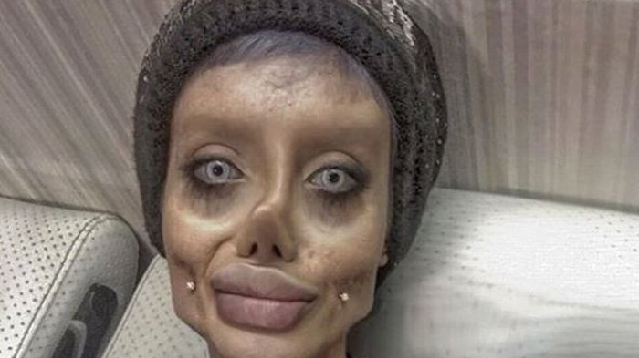 Wanita yang Ingin Seperti Angelina Jolie Ini Sanggah Lakukan 50 Operasi, Tetapi Ini yang Dilakukan