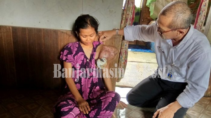 Dijemput Ambulan, Biaya Operasi Penderita Tumor Desa Tanjung Harapan Ditanggung APBD Batola