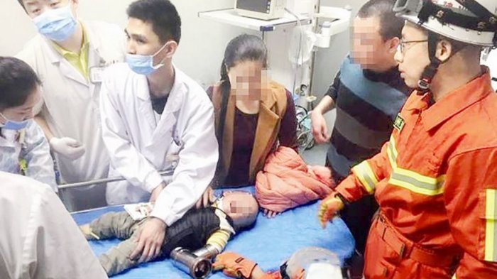 Ngeri, Tangan Balita Ini Terperangkap di Mesin Penggiling Daging