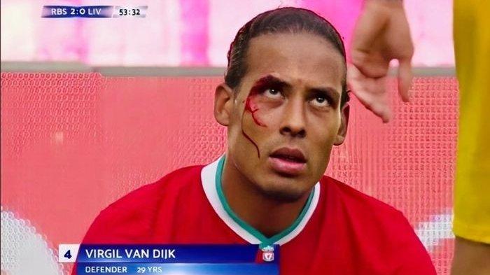 Prediksi & H2H Liverpool vs Arsenal di Piala Community Shield, Adu Juara Liga Inggris dan Piala FA