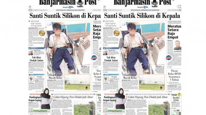 Tidak Menyediakan Silikon Cair Peninggi Badan, Beberapa Salon Hanya Menawarkan ini