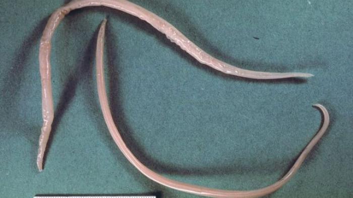 Mengerikan! 4 Cacing Parasit di Antaranya Ada dalam Daging Babi