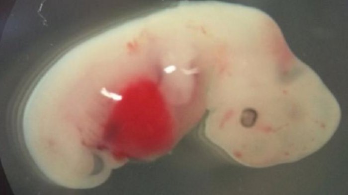 Wow! Ilmuwan Ciptakan Embrio Campuran Babi dan Manusia Pertama di Dunia