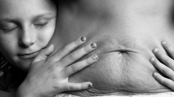 Foto-foto Ini Berbicara Tentang Perempuan