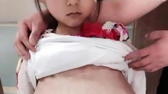 Gadis Cilik Ini Hamil Bersuamikan Pria 40 Tahun, Korban Perdagangan Manusia?