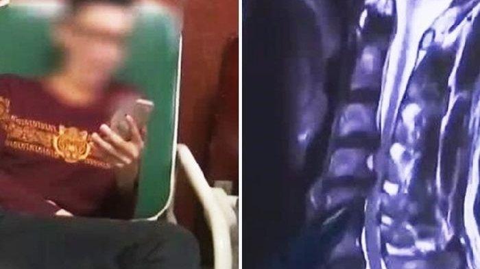 Bangun Tidur, Pria ini Mengalami Kesulitan Bernafas, Setelah Diperiksa Ternyata Gara-gara ini