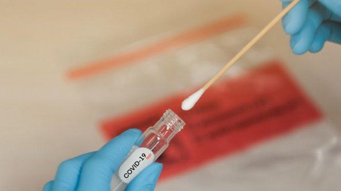 BREAKING NEWS: Covid-19 Indonesia 26 Oktober 2021 Tambah 611 Kasus Baru, Sembuh 1.141