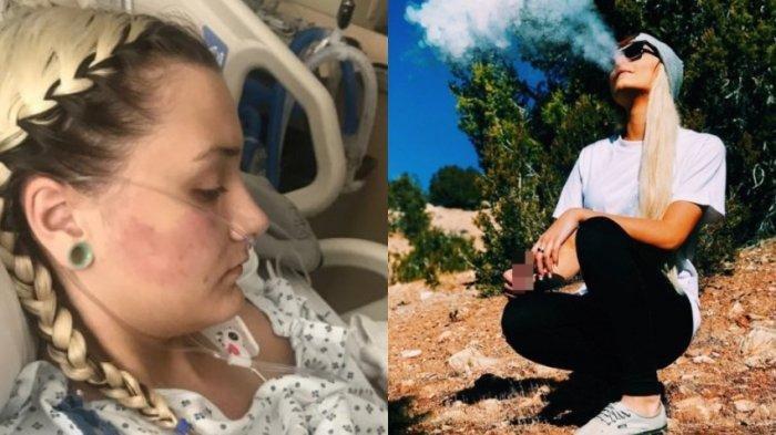 Isap Vape Selama 3 Tahun, Remaja Putri 18 Tahun Ini Koma Akibat Derita Sakit Paru-paru Akut